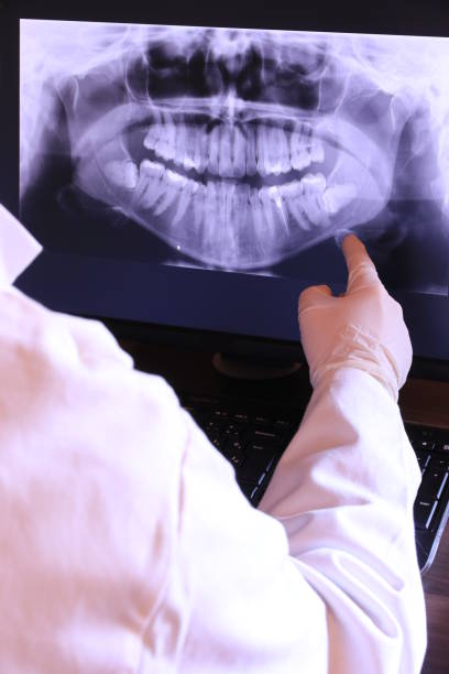 Best Emergency Tooth Extraction in Atwater, MN
